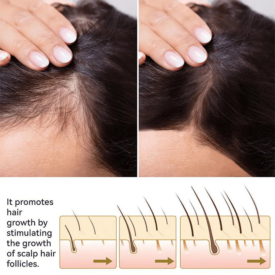 FEG Plus Hair Growth Spray for Head and Beard